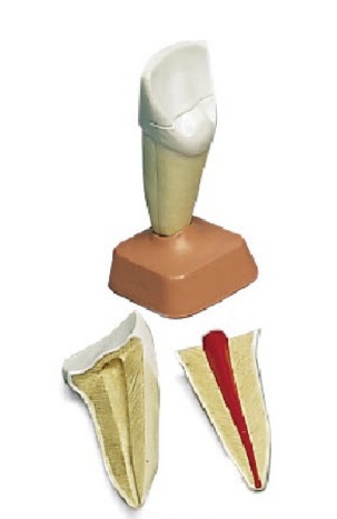 上颌切齿解剖模型(2部件)