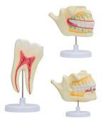 乳牙恒牙排列模型