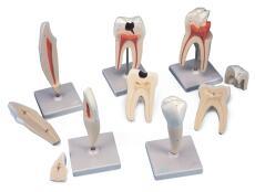 经典牙齿模型（5种牙）