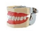 标准牙模型（软牙龈,螺丝固定,FE颌架）