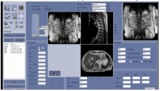MRI模拟操作教学系统
