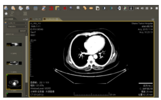 医学影像诊断电子阅片系统