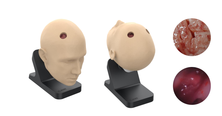 颅脑血肿清除训练模型