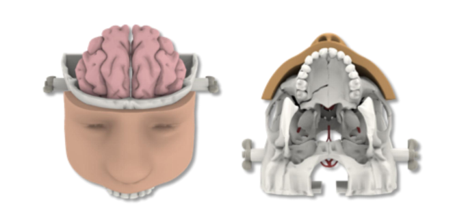经鼻入路磨骨模型