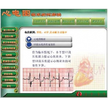 新版心电图教学软件