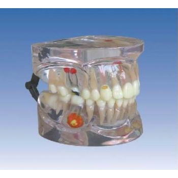 乳牙病态模型