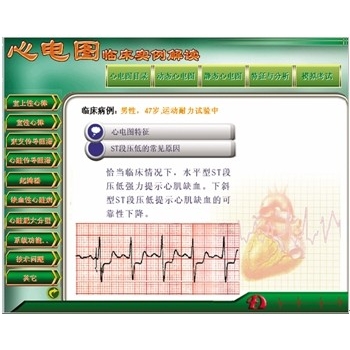 新版心电图教学软件—-【心电图临床实例解读】